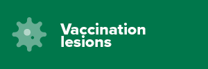 Vaccination Lesions